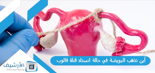 أين تذهب البويضة في حالة انسداد قناة فالوب