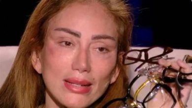 ريهام سعيد بعد عملية التجميل