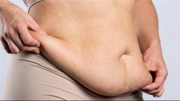 تجربتي في التخلص من الكرش بعد الولادة