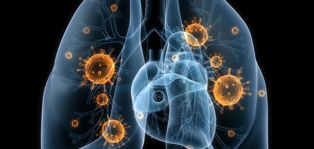 شفيت من سرطان الرئة