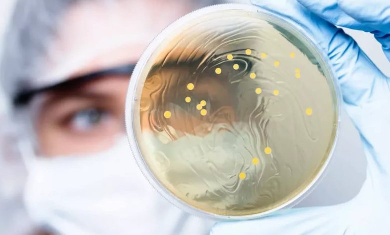 أسباب حمى التيفوئيد وطريقة العلاج