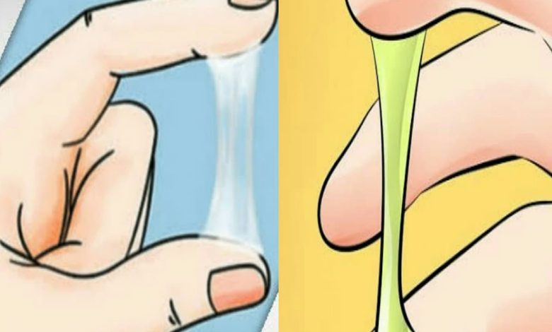 اسباب افرازات المهبل البيضاء