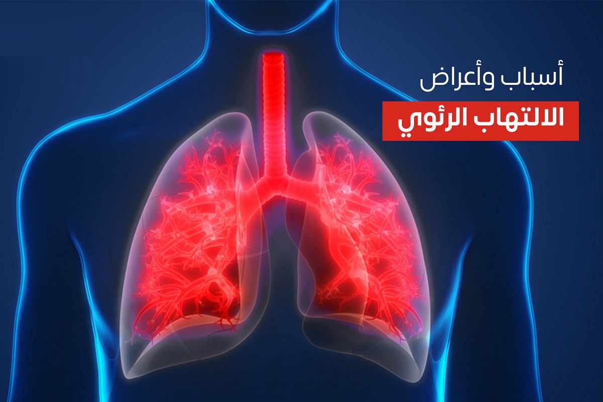 اسباب الالتهاب الرئوي 1 اسباب الالتهاب الرئوي