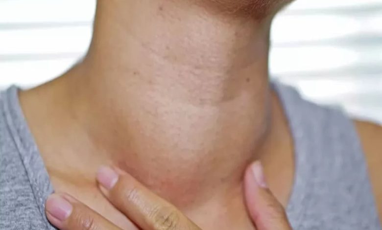 اسباب التهاب الغدد الليمفاوية