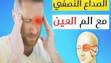 اسباب الصداع النصفي