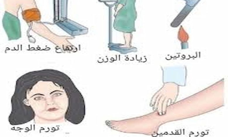 اسباب تسمم الحمل