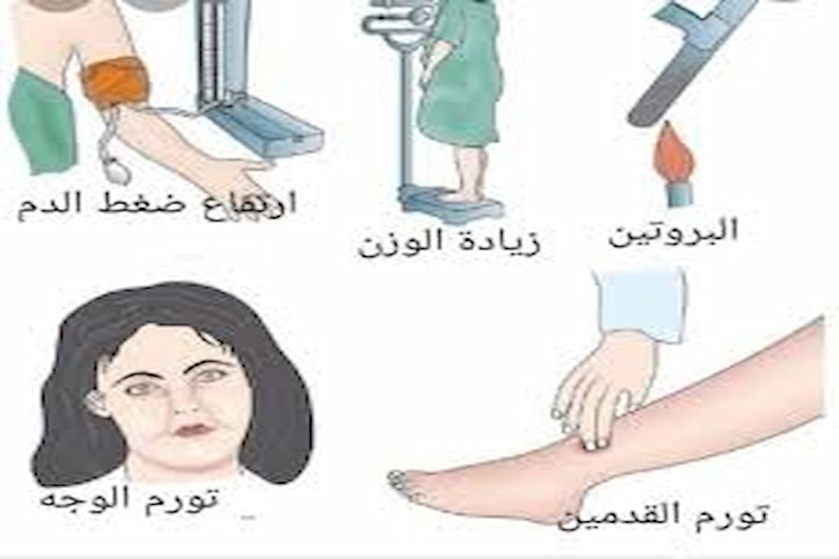 اسباب تسمم الحمل 1 اسباب تسمم الحمل