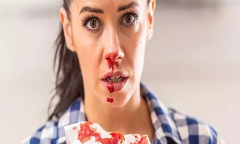 اسباب نزيف الانف