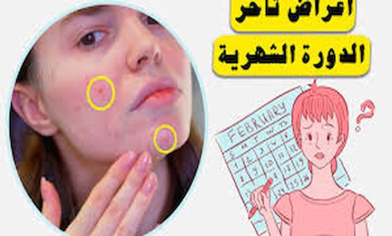 سبب تاخير الدوره الشهريه