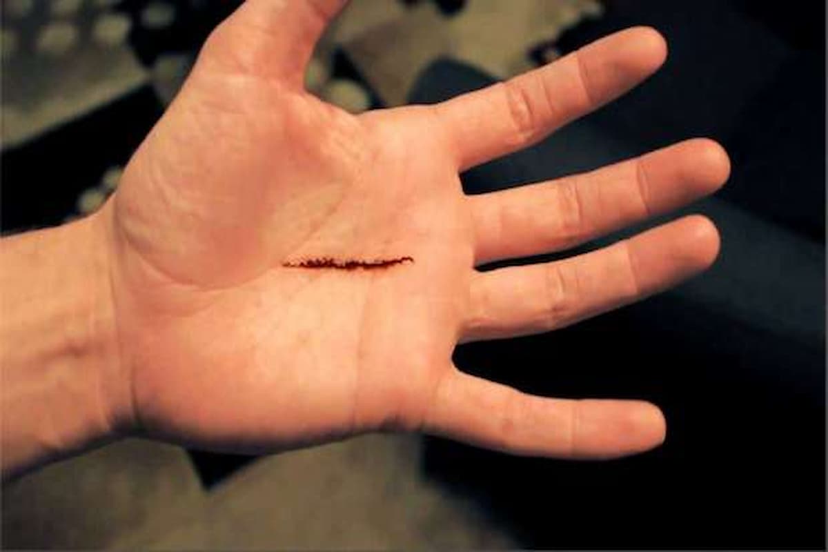 تفسير حلم قطع اليد لشخص آخر