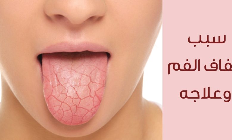 سبب جفاف الحلق رغم شرب الماء