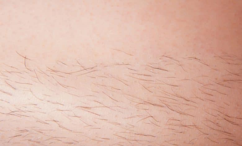 سبب ظهور شعر في الثدي والبطن للعزباء