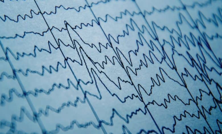 هل يمكن للأطفال الشفاء من كهرباء المخ الزائدة؟