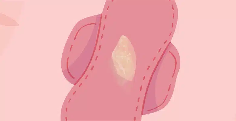 أسباب نزول إفرازات مخاطية وقت الحمل