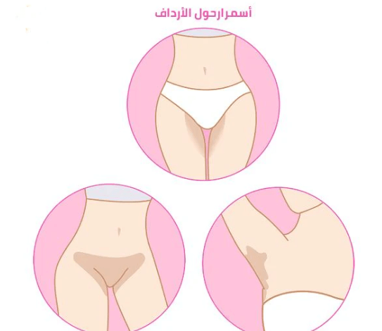 المناطق الحساسة