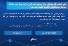 نجاح عملية استبدال مفصل الورك تعيد الحركة لمريضة في مستشفى الأمير متعب بالجوف 3 2502447.jpgw800q100fjpg